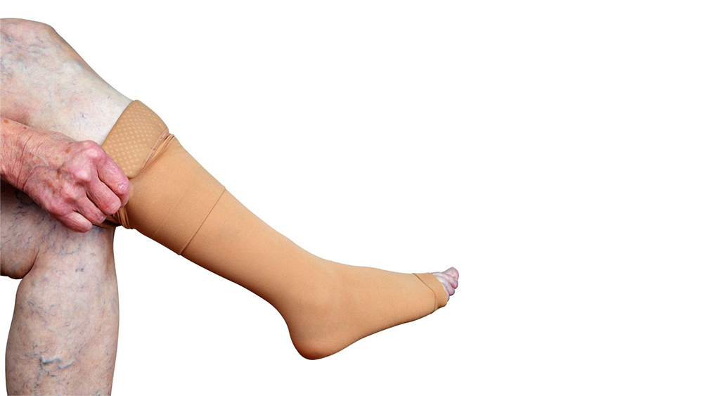 Can Compression Stockings for Varicose Veins Help?