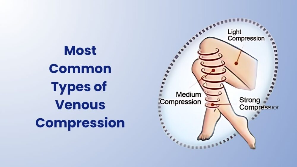 Types of Venous Compression - Best Vein Varicose Clinic in Victoria Melbourne