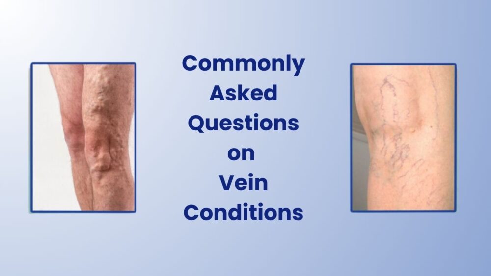 Vein Problems: Expert Answers on FAQs - Best Vein Varicose Clinic in Victoria Melbourne